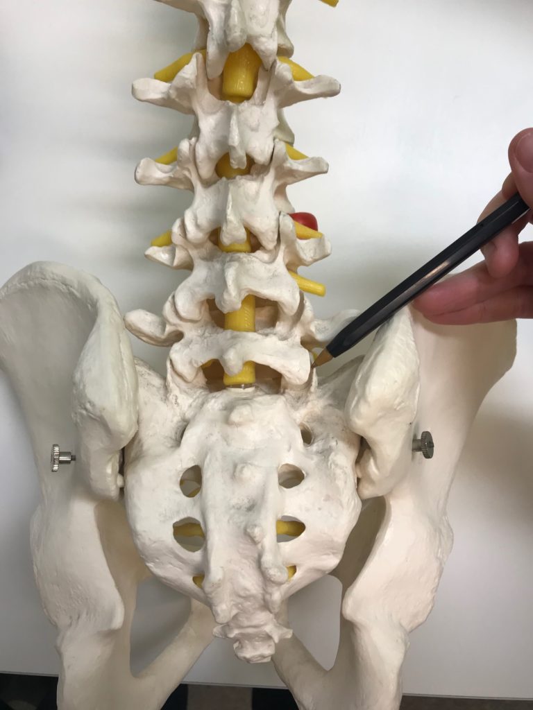 Image of Facet Joint Dysfunction frontal view