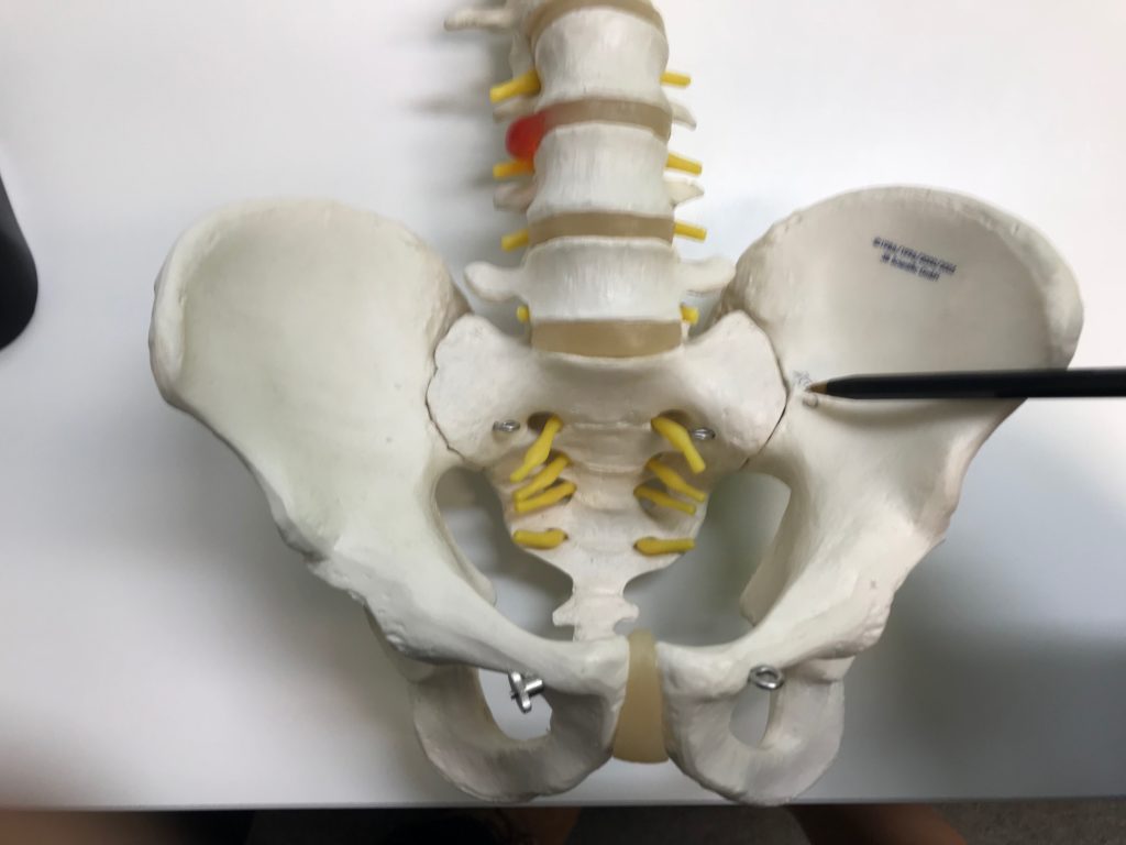 Image of Sacroiliac Joint