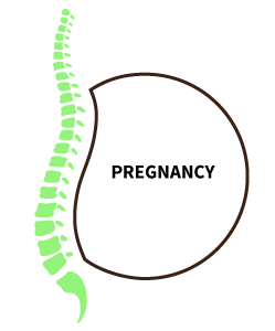Pregnancy can cause sciatica pain
